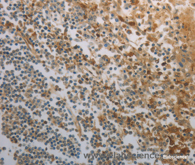 Immunohistochemistry of paraffin-embedded Human tonsil tissue using INHA Polyclonal Antibody at dilution 1:150