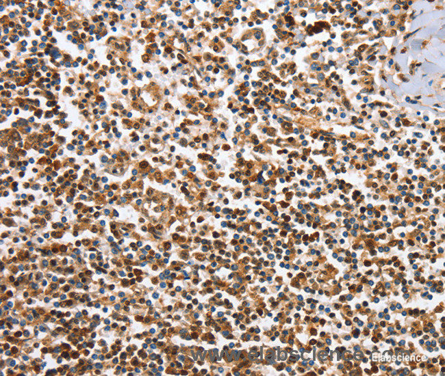 Immunohistochemistry of paraffin-embedded Human tonsil tissue using IRAK3 Polyclonal Antibody at dilution 1:50