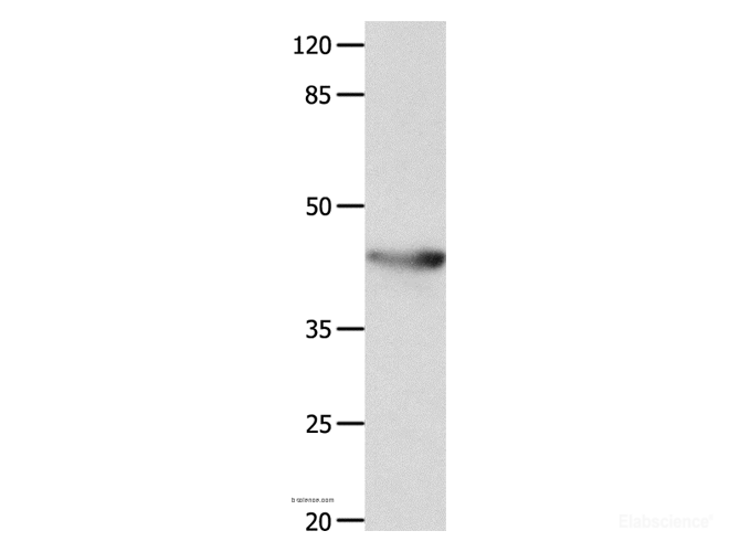 Western Blot analysis of Mouse spleen tissue using KCNA5 Polyclonal Antibody at dilution of 1:700