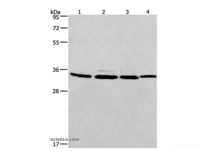 Western Blot analysis of A549, 231, PC3 and hela cell using MAD2L1BP Polyclonal Antibody at dilution of 1:675