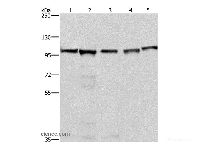 Western Blot analysis of 293T, A549, Raji, K562 and NIH/3T3 cell using MCM6 Polyclonal Antibody at dilution of 1:433.3