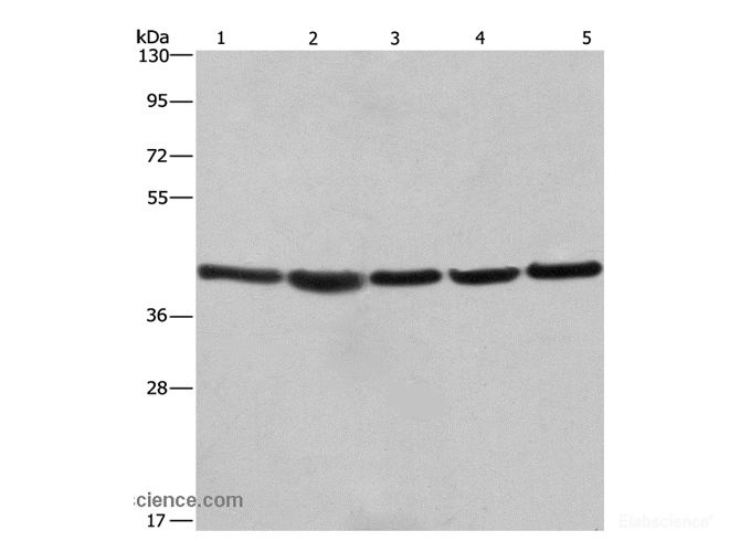 Western Blot analysis of A549, NIH/3T3 and 293T cell,Human hepatocellular carcinoma tissue and hela cell using RPSA Polyclonal Antibody at dilution of 1:433.3