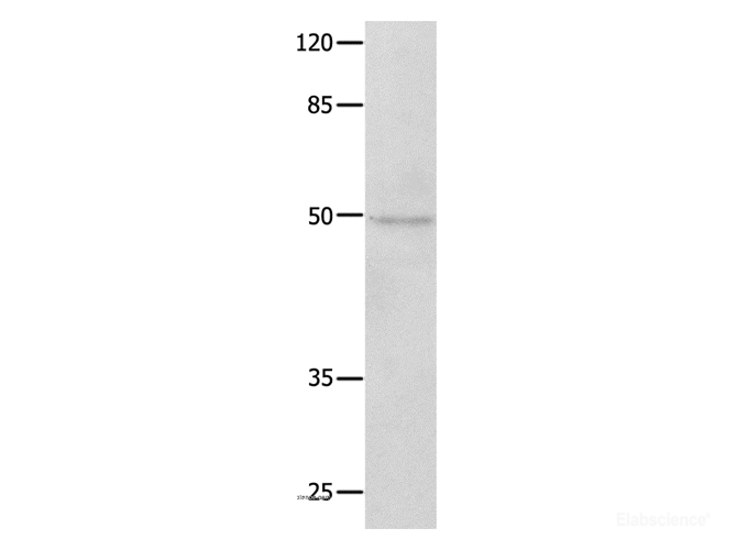 Western Blot analysis of Jurkat cell using NAP1L1 Polyclonal Antibody at dilution of 1:650