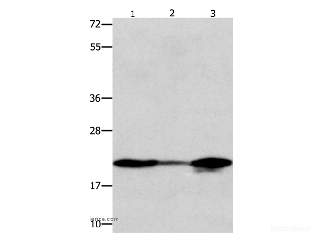 Western Blot analysis of 231 and A549 cell, Human liver cancer tissue using NME1 Polyclonal Antibody at dilution of 1:600