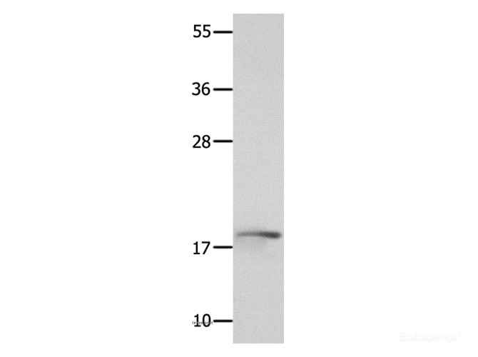 Western Blot analysis of Mouse kidney tissue using NME3 Polyclonal Antibody at dilution of 1:800