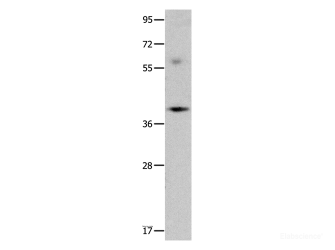 Western Blot analysis of Mouse brain tissue using OPCML Polyclonal Antibody at dilution of 1:400