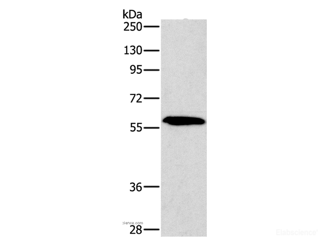 Western Blot analysis of A172 cell using PAK2 Polyclonal Antibody at dilution of 1:400