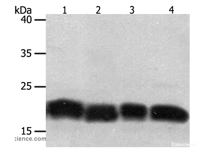 Western Blot analysis of Jurkat and hela cell, Human fetal lung tissue and A549 cell using PDCD6 Polyclonal Antibody at dilution of 1:200