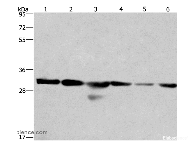 Western Blot analysis of 293T and A549 cell, Human hepatocellular carcinoma tissue and PC3 cell,hela cell and Mouse heart tissue using PHB Polyclonal Antibody at dilution of 1:500