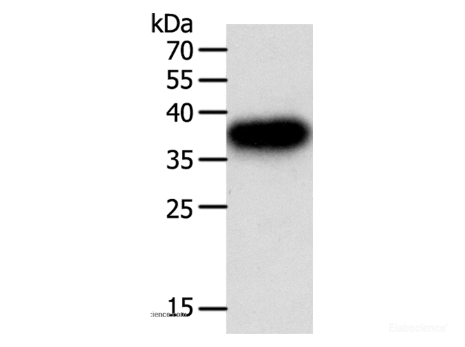 Western Blot analysis of A549 cell using PLAUR Polyclonal Antibody at dilution of 1:400