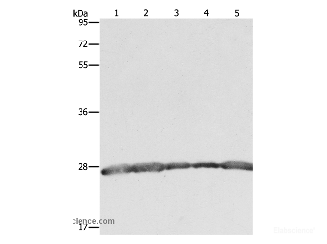 Western Blot analysis of Hela, 293T and MCF7 cell, Human fetal brain tissue and Jurkat cell using PRDX3 Polyclonal Antibody at dilution of 1:800