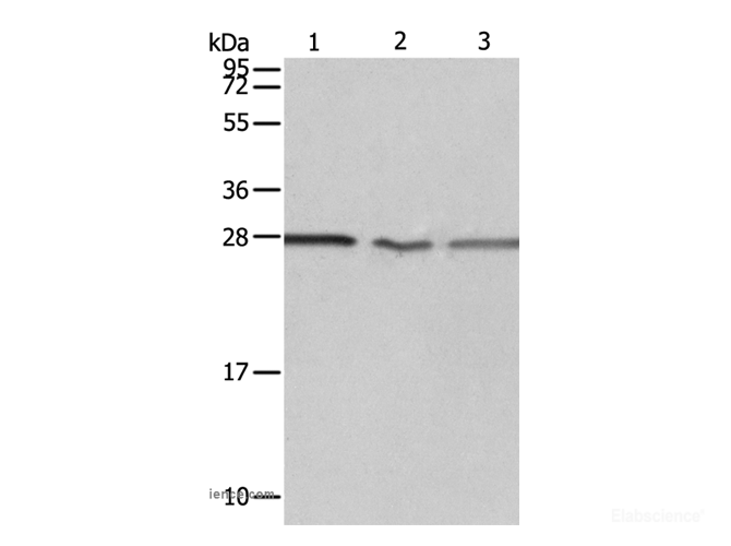 Western Blot analysis of Jurkat, A549 cell and Human fetal kidney tissue using PSMD9 Polyclonal Antibody at dilution of 1:750