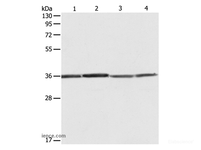 Western Blot analysis of Hela, 293T, A431 and Jurkat cell using RPLP0 Polyclonal Antibody at dilution of 1:600