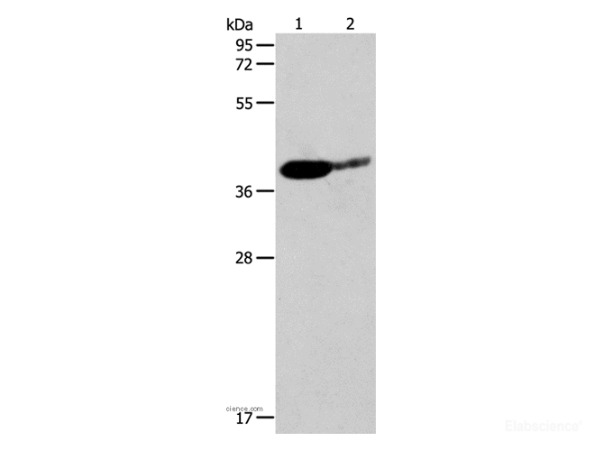 Western Blot analysis of Mouse brain and Human liver cancer tissue using SIRT3 Polyclonal Antibody at dilution of 1:500