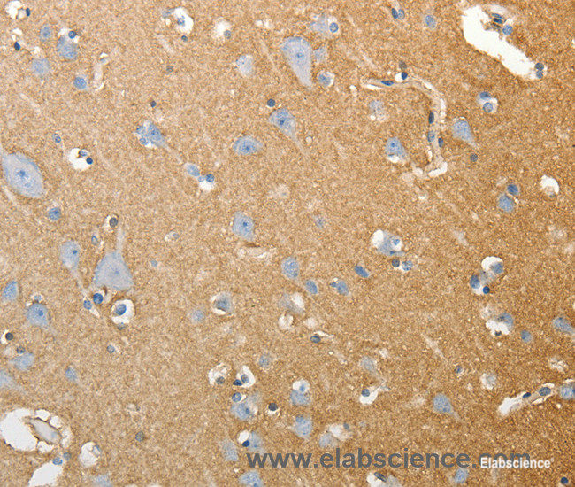 Immunohistochemistry of paraffin-embedded Human brain tissue using SLC4A4 Polyclonal Antibody at dilution 1:50