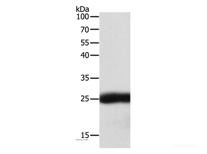 Western Blot analysis of Hela cell using SNAP25 Polyclonal Antibody at dilution of 1:400