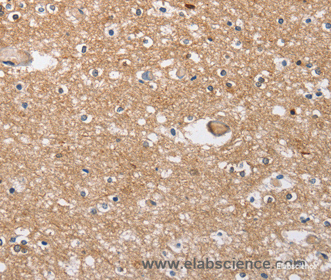 Immunohistochemistry of paraffin-embedded Human brain tissue using SOCS2 Polyclonal Antibody at dilution 1:40