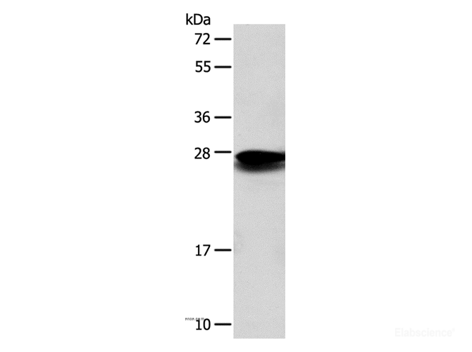 Western Blot analysis of Mouse liver tissue using SOD2 Polyclonal Antibody at dilution of 1:650