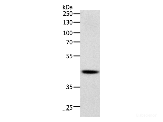 Western Blot analysis of Human lymphoma tissue using SOX-7 Polyclonal Antibody at dilution of 1:750