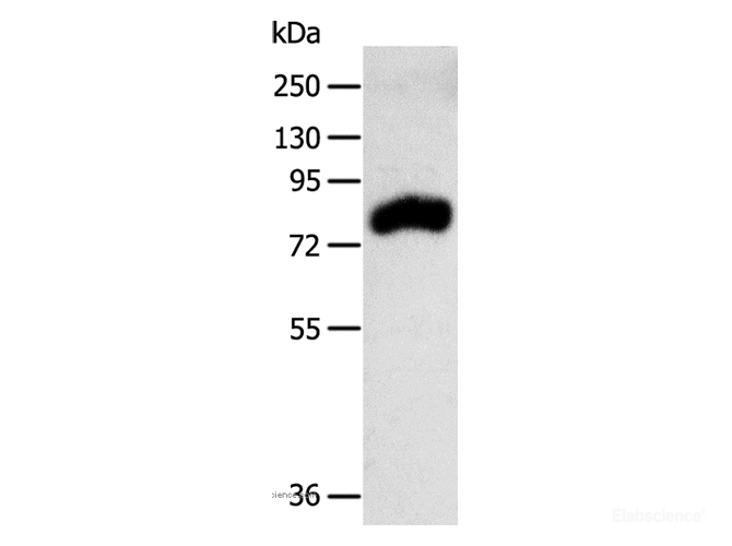 Western Blot analysis of Mouse kidney tissue using RPAP3 Polyclonal Antibody at dilution of 1:400
