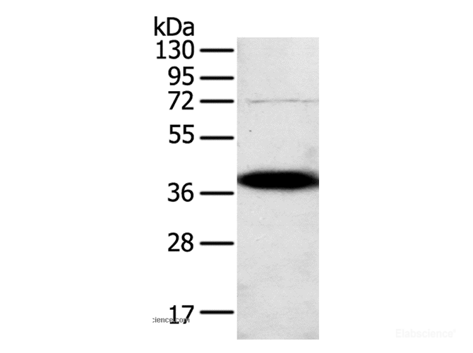 Western Blot analysis of A375 cell using SPARC Polyclonal Antibody at dilution of 1:500