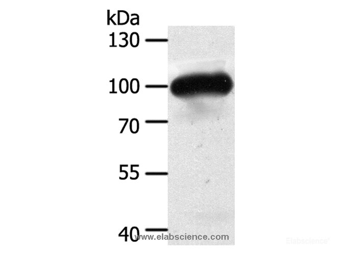 Western Blot analysis of Mouse heart tissue using MAP4K3 Polyclonal Antibody at dilution of 1:400