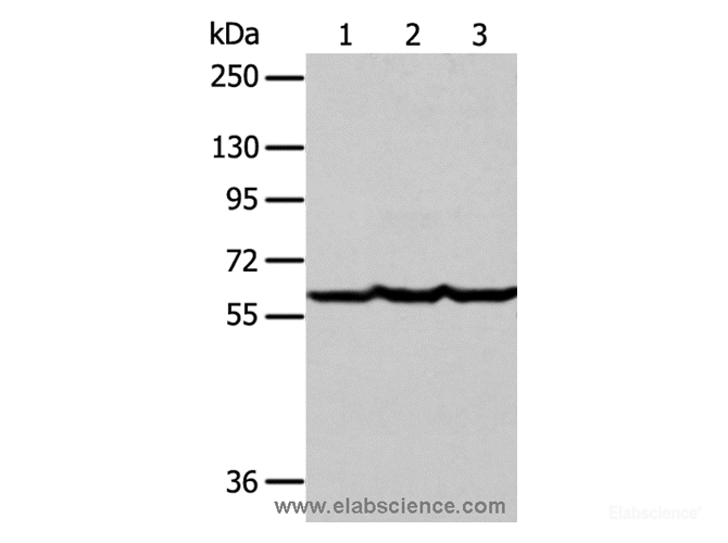 Western Blot analysis of Human liver cancer tissue, hela and Jurkat cell using Factor IX Polyclonal Antibody at dilution of 1:400