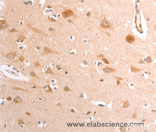 Immunohistochemistry of paraffin-embedded Human brain tissue using TRPV4 Polyclonal Antibody at dilution 1:40