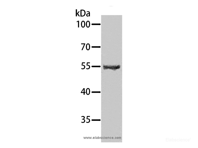 Western Blot analysis of Human testis tissue using SPATA6 Polyclonal Antibody at dilution of 1:1000