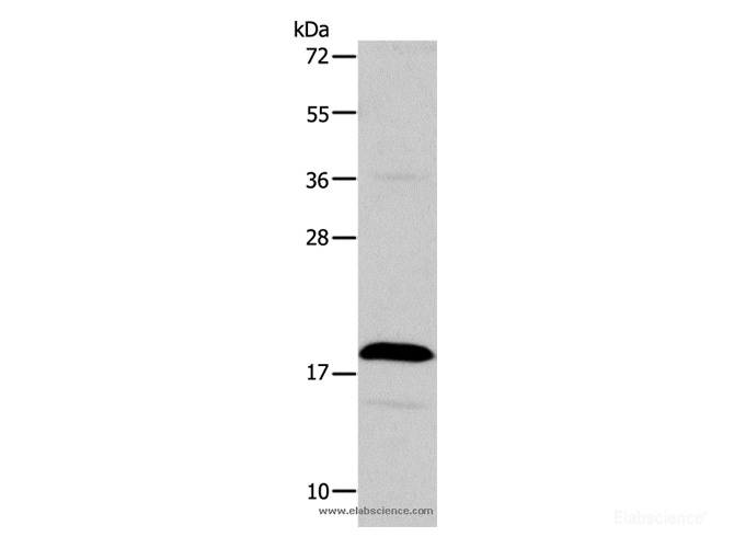 Western Blot analysis of Jurkat cell using TSLP Polyclonal Antibody at dilution of 1:850