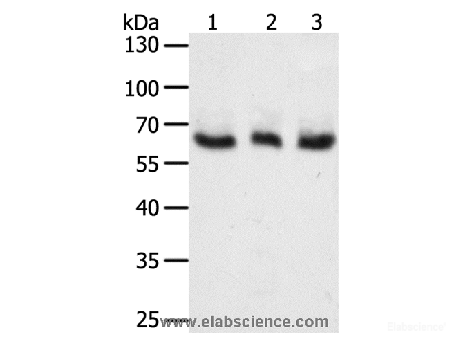 Western Blot analysis of A375, Hela and Jurkat cell using TYR Polyclonal Antibody at dilution of 1:400