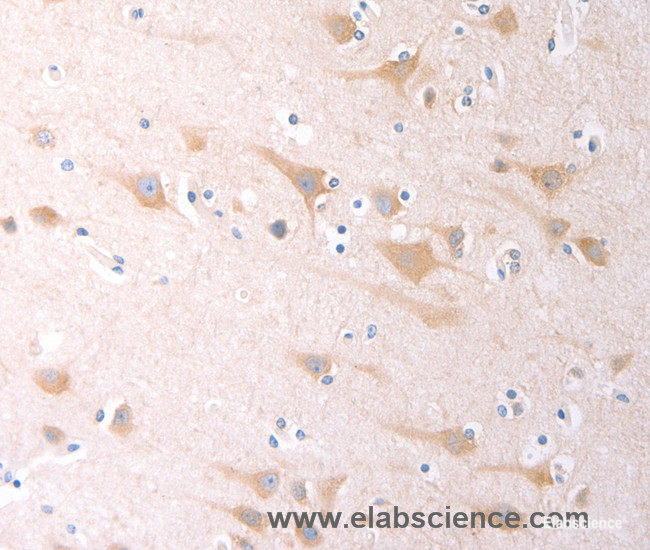 Immunohistochemistry of paraffin-embedded Human brain tissue using SCGB1A1 Polyclonal Antibody at dilution 1:60