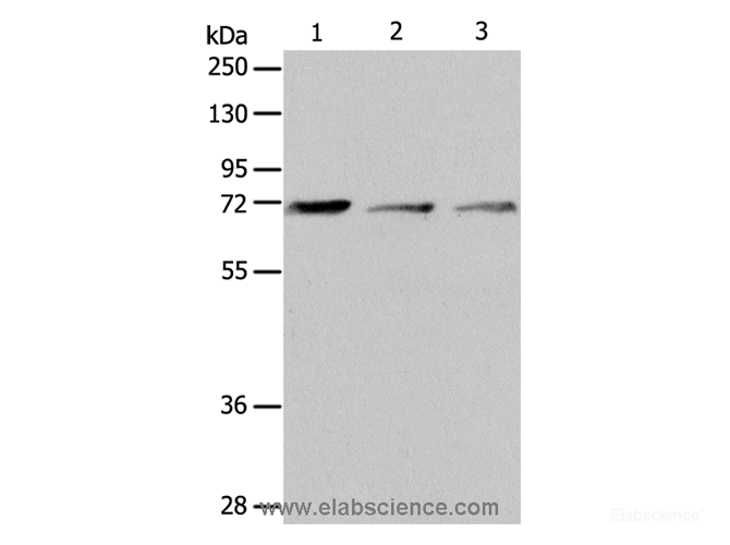 Western Blot analysis of RAW264.7 cell and Human liver cancer tissue, SP20 cell using CD218b Polyclonal Antibody at dilution of 1:650
