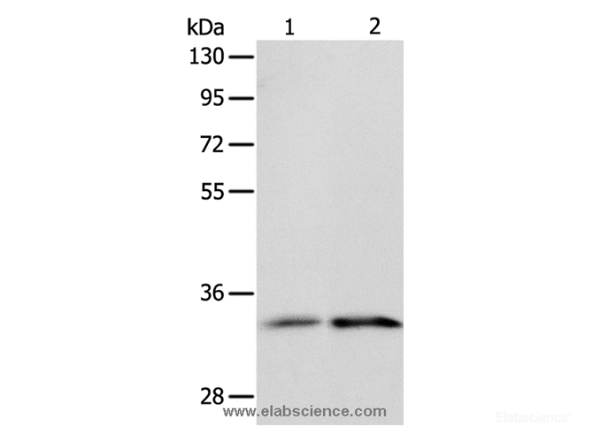 Western Blot analysis of Human fetal kidney and intestine tissue using ST2 Polyclonal Antibody at dilution of 1:1100