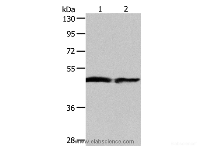 Western Blot analysis of Human fetal liver and liver cancer tissue using AADAC Polyclonal Antibody at dilution of 1:550