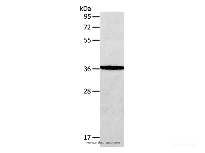 Western Blot analysis of Human fetal brain tissue using AASDHPPT Polyclonal Antibody at dilution of 1:650