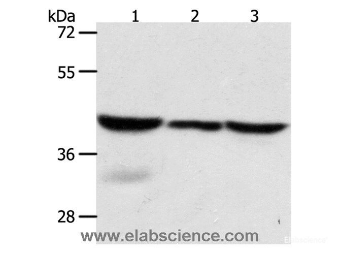 Western Blot analysis of Mouse lung and Human fetal lung tissue, hela cell using CAPG Polyclonal Antibody at dilution of 1:700