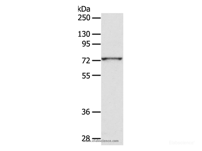 Western Blot analysis of PC3 cell using CD156c Polyclonal Antibody at dilution of 1:300