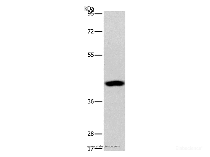 Western Blot analysis of Human lymphoma tissue using PHYKPL Polyclonal Antibody at dilution of 1:550