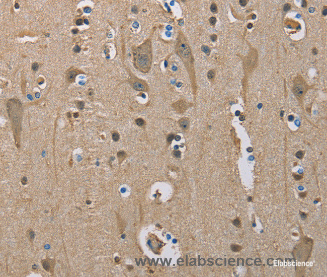 Immunohistochemistry of paraffin-embedded Human brain tissue using SERPINA1 Polyclonal Antibody at dilution 1:50