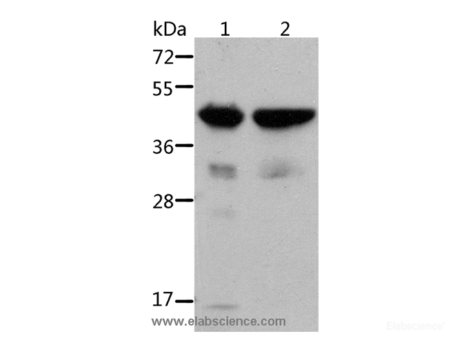 Western Blot analysis of Mouse muscle and heart tissue using ACTA1 Polyclonal Antibody at dilution of 1:500