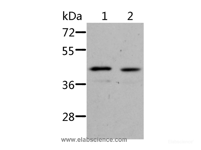 Western Blot analysis of Jurkat cell and Human fetal kidney tissue using NIF3L1 Polyclonal Antibody at dilution of 1:500