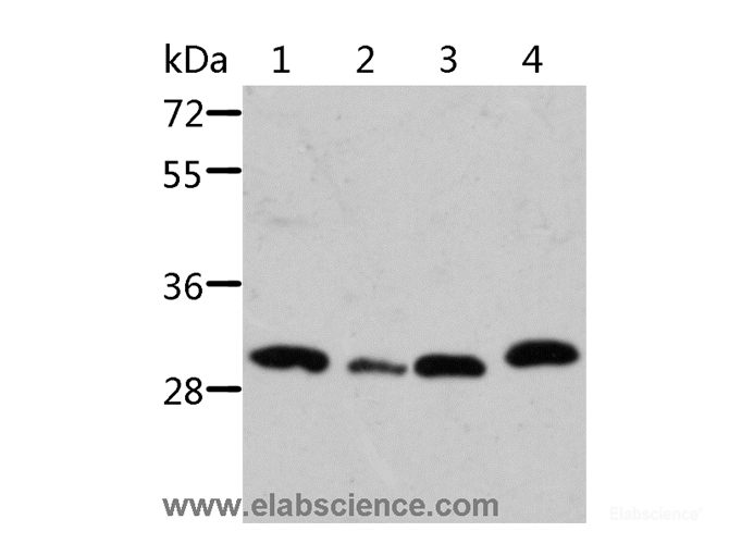 Western Blot analysis of Mouse pancreas and spleen tissue, Mouse heart tissue and 293T cell using STRADB Polyclonal Antibody at dilution of 1:500