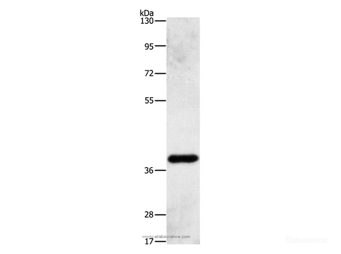 Western Blot analysis of Human fetal liver tissue using AMPK gamma1 Polyclonal Antibody at dilution of 1:500
