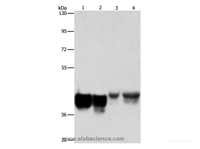 Western Blot analysis of Hela and 293T cell, Mouse liver tissue and NIH/3T3 cell using AUP1 Polyclonal Antibody at dilution of 1:500