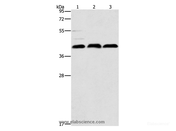 Western Blot analysis of K562 cell, Mouse kidney tissue and Raji cell using ATG3 Polyclonal Antibody at dilution of 1:325