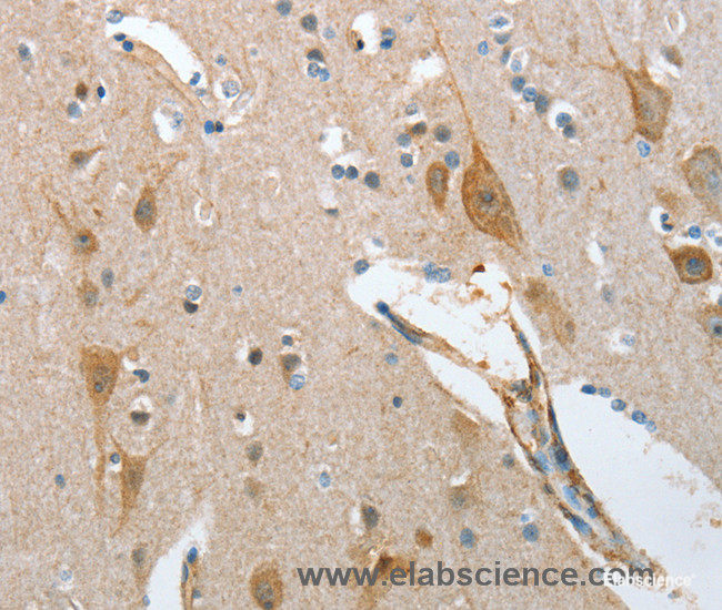 Immunohistochemistry of paraffin-embedded Human brain tissue using NOL3 Polyclonal Antibody at dilution 1:35