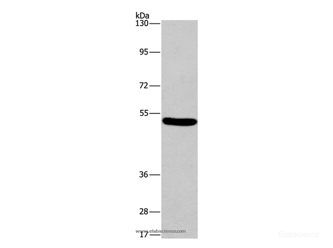 Western Blot analysis of Mouse brain tissue using ARC Polyclonal Antibody at dilution of 1:597