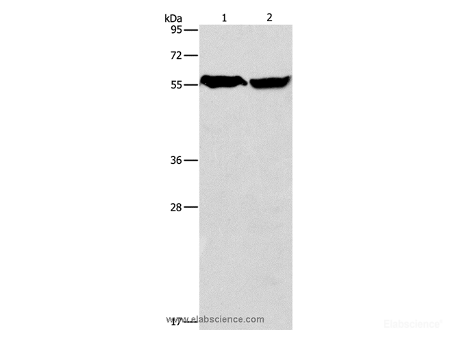 Western Blot analysis of Mouse heart and Human fetal brain tissue using ARHGEF9 Polyclonal Antibody at dilution of 1:950