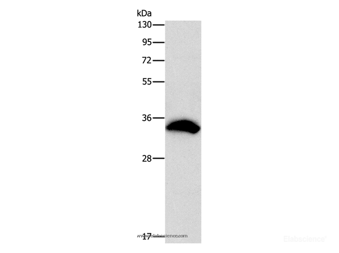 Western Blot analysis of 293T cell using CDCA8 Polyclonal Antibody at dilution of 1:800